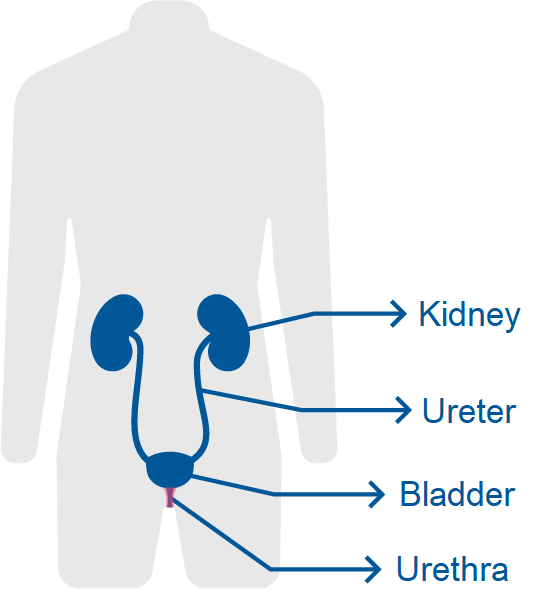uretritis